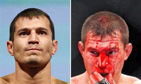 Shocking before and after photographs of mashed up mma. UFC Fighters Before And After A Fight (15 pics)