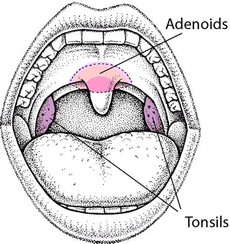 Table Locating The Tonsils And Adenoids Msd Manual Consumer Version