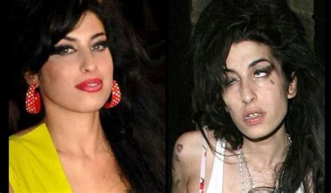 Fotos Del Antes Y Después De Amy Winehouse Y Otras Famosas Adictas A Las Drogas