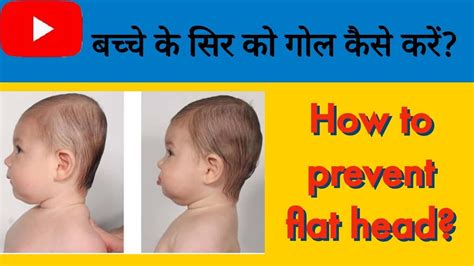 How To Prevent Flat Head In Babies बच्चे के सिर को गोल कैसे बनाये How