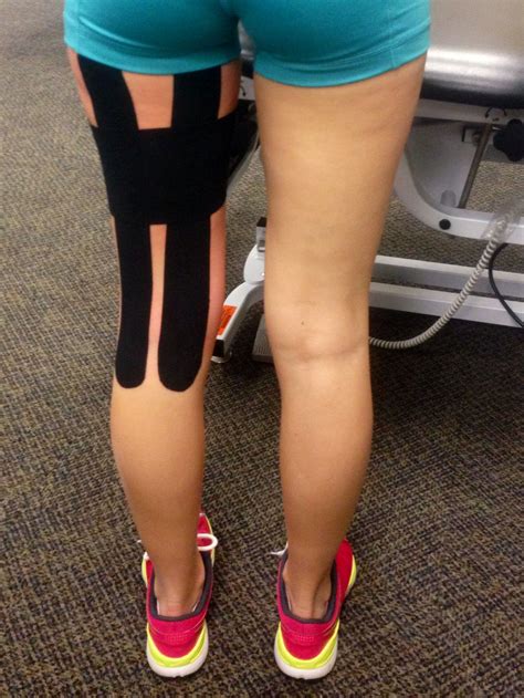 Taping For Torn Hamstring Mlrusch We Should Have Done This For Your Hammy Kinesiology Taping