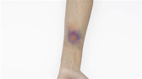 How To Make A Fake Bruise Using Halloween Makeup Gails Blog