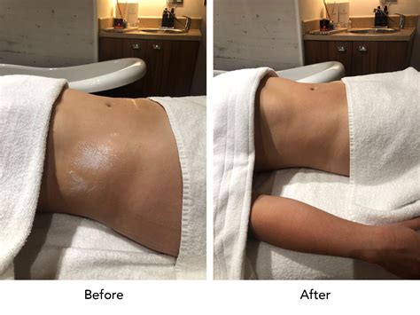 At the same time, though, it could potentially provide clients with a variety of ancillary health benefits. Lymphatic Drainage Massage - Geruse Beauty