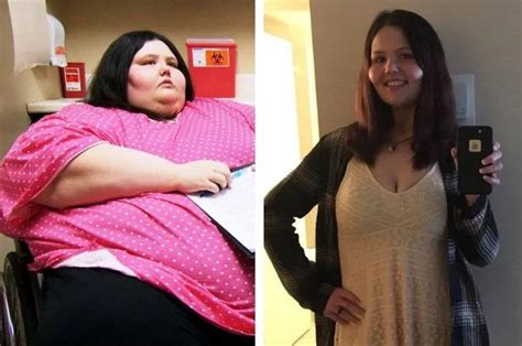 Я вешу 300 кг что было дальше — 5 драматических историй похудения с фото до и после
