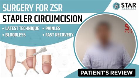 Stapler Circumcision ZSR Chandigarh Punjab Best Hospital Bloodless