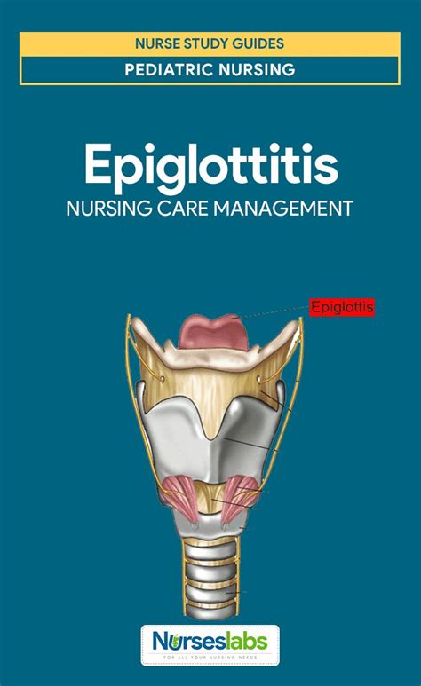 Epiglottitis Nursing Care Planning And Management A Study Guide