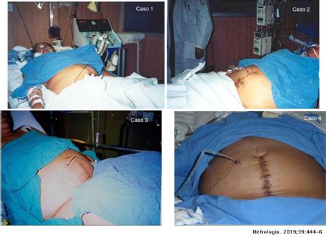 Simple Science: How to Make a Volcano with Kids