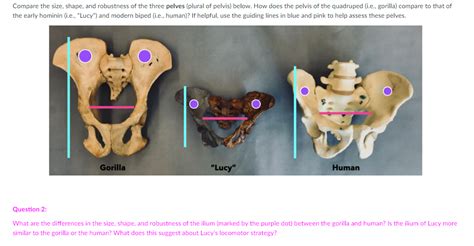 Solved Module 1 Bipedal Adaptations Of The Skull The