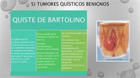 Quiste De Bartolino 34 Carrotapp