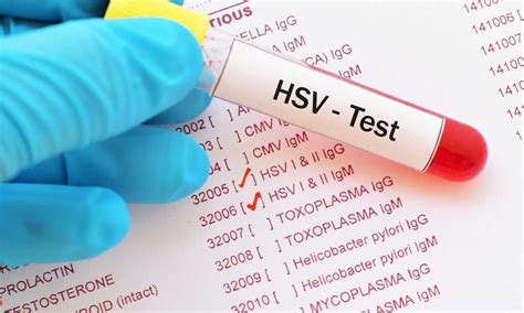 Molbio Diagnostics Unveils Herpes Simplex Virus Test Truenat Hsv 12