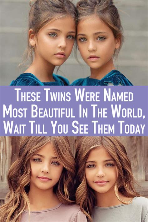 These Twins Were Named Most Beautiful In The World Wait Till You See Them Today Beautiful