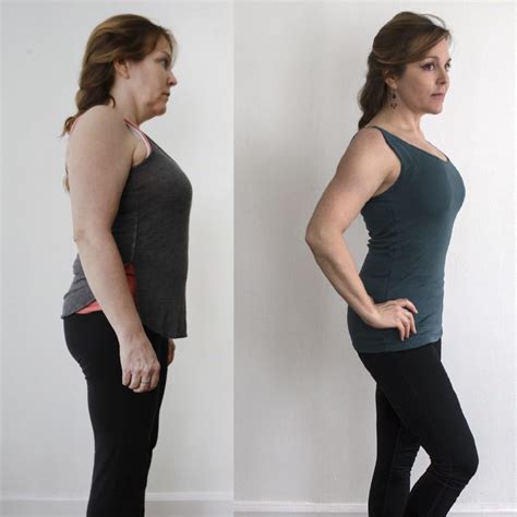 Weight Loss Injections Before And After Weightlosslook