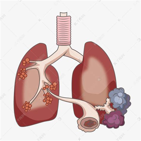 慢性阻塞性肺疾病素材图片免费下载 千库网