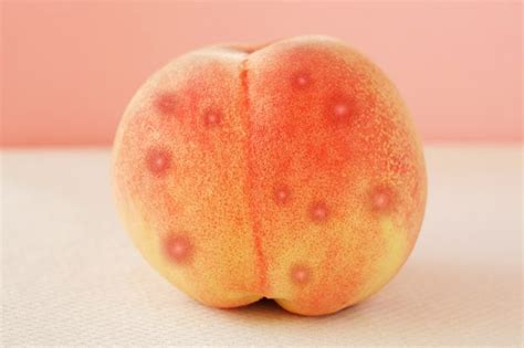 Butt Acne Heres The Best Way To Get Rid Of It Chatelaine