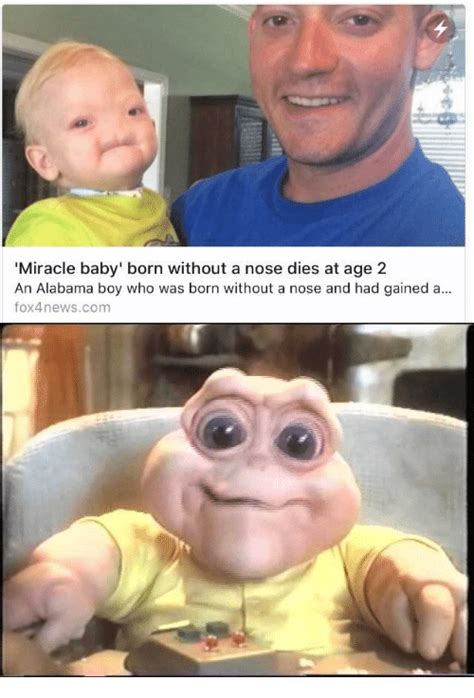 Miracle Baby Born Without A Nose Dies At Age 2 An Alabama Boy Who Was