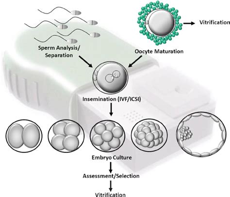 Schematic Of Basic Steps Involved In The In Vitro Fertilization Process