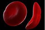 This protein imparts the color of blood. Red Blood Cells: Function and Structure