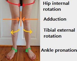 How To Fix Knee Valgus Posture Direct