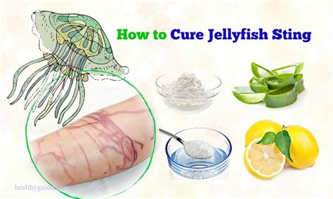 16 Tips How To Cure Jellyfish Sting Rash And Itching Naturally After A Week