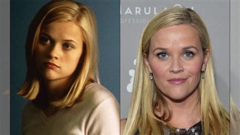 Reese Witherspoon Celebrity Plastic Surgery Review With Rachel Varga YouTube