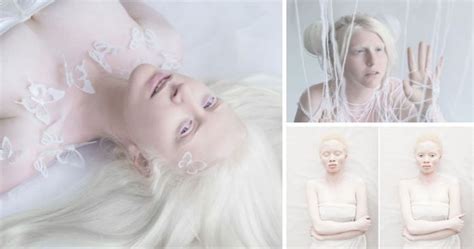 These Photos Of Albino People Are Taking The Internet By Storm