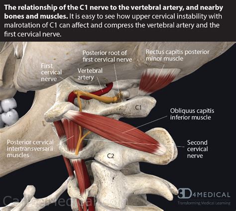 Torticollis In Adults