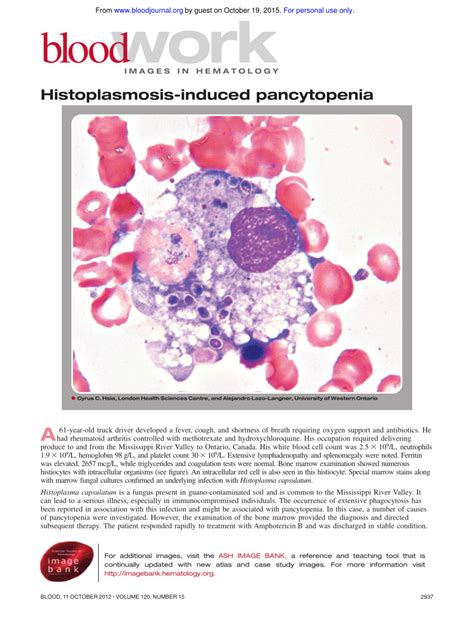 PDF Histoplasmosis Induced Pancytopenia