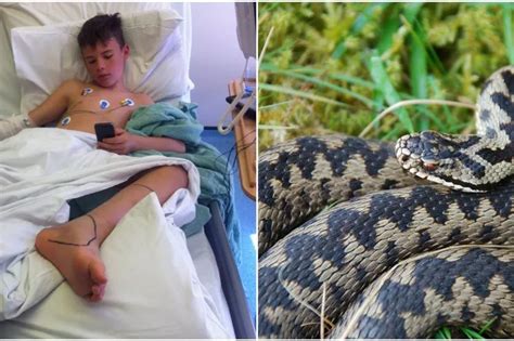 Gwynedd beach snake bites boy so badly it leaves him on hospital heart