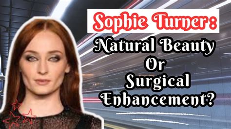 Did Sophie Turner Had Undergone Buccal Fat Removal Surgery Celeb