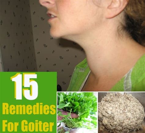 57 Best Images About Goiter On Pinterest Thyroid Treatment Dandelion