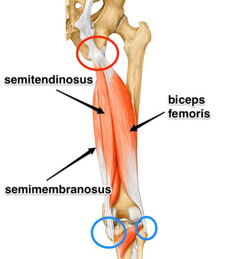 Hamstring Tendon Popping