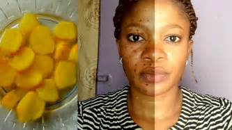 Foods or medications that have stained the tongue 3. REMOVE DARK SPOTS IN 7 DAYS |100% NATURAL RECIPE HOME ...