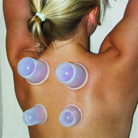 Cupping Therapy Set Massage Cups By Dosensepro Acupuncture Home