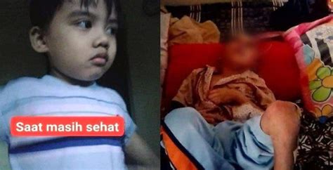 Viral Bocah Tahun Di Bandung Diduga Dianiaya Orangtua Kandung Hingga