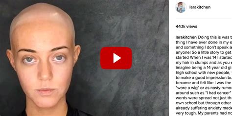 This Model Is Embracing Her Alopecia—and Showing Off An Amazing Wig In