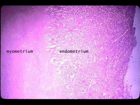 The innermost layer of myometrium is known as the junctional zone, which becomes thickened in adenomyosis. MYOMETRIUM , HEALTH EDUCATION , ICSP , URDU / HINDI - YouTube