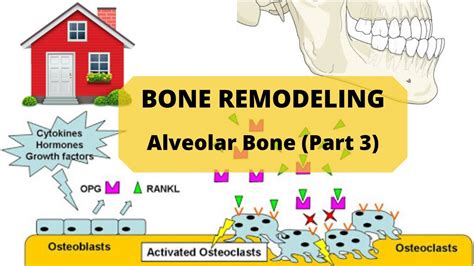Bone Remodeling Alveolar Bone Part 3 Youtube