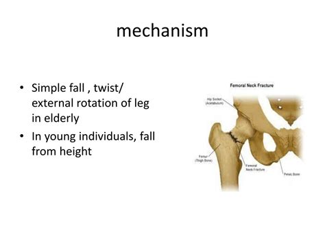 Ppt Fracture Neck Of Femur Powerpoint Presentation Free Download