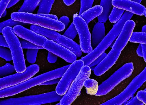 Escherichia Coli Superior A 100.000 Ufc Ml