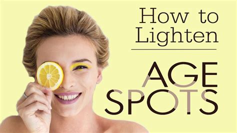 How To Get Rid Of Age Spots Naturally Home Remedies For Age Spots Removal Youtube