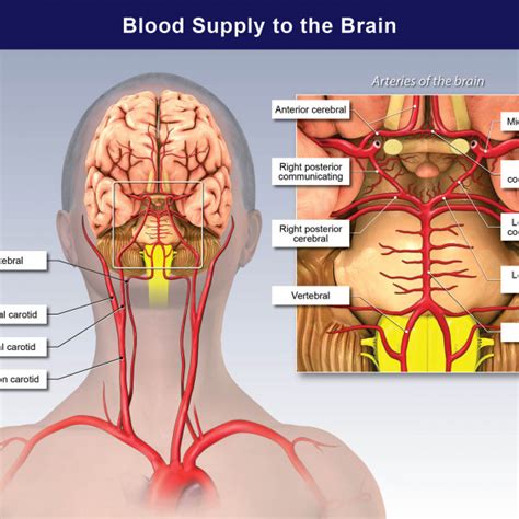 Blood Supply To The Brain Anterior View Trialexhibits Inc