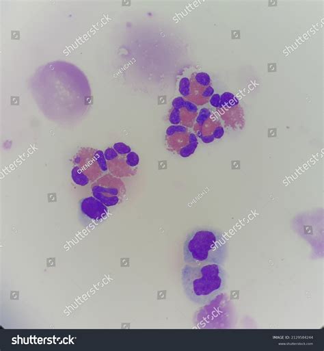 Eosinophils Cell Body Fluid Stock Photo 2129584244 Shutterstock