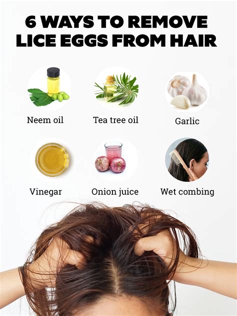 How To Remove Head Lice Eggs At Home Tutorial Pics