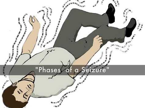 Defining Seizures By Basil Asay