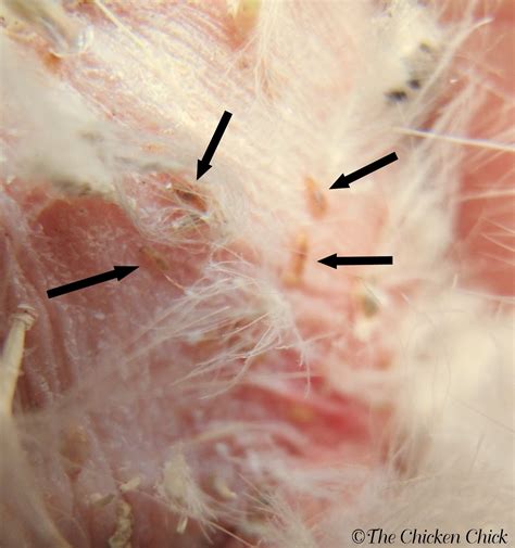 Poultry Lice And Mites Identification And Treatment The Chicken Chick