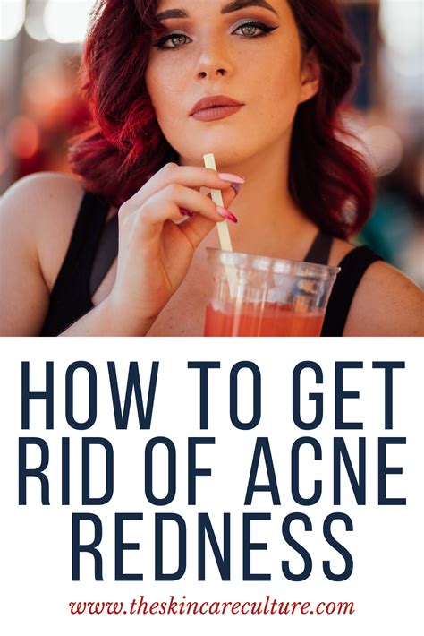Most Of The Time Acne Scars Become Dark Or Discolored Patches Called