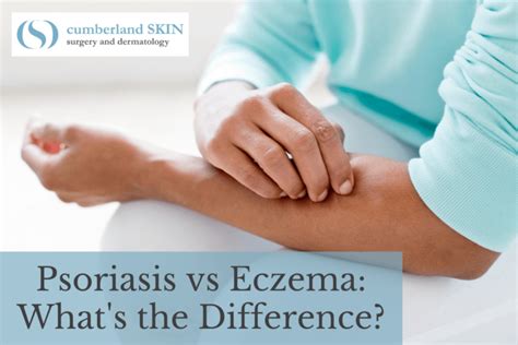 Psoriasis Vs Eczema Whats The Difference How Do They Compare