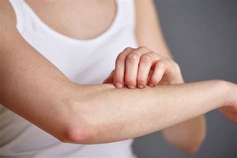 Menthoxypropanediol Provides Itch Relief In Atopic Dermatitis