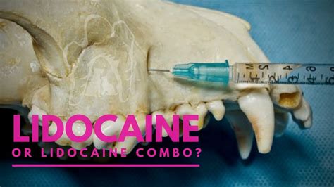 Lidocaine Vs Lidocaine Combo Which Medicine Is Better For Nerve