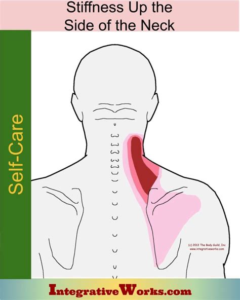 Stiff Neck Pain Patterns Causes And Self Care Integrative Works
